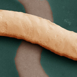 Metal tracks crossing in a stretchable circuit