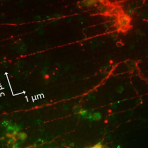 Retinal Neurons Cultured on GaP NanoWires