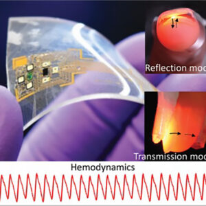 Skin-interfaced PPG device